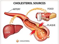 cholesterol250.jpg